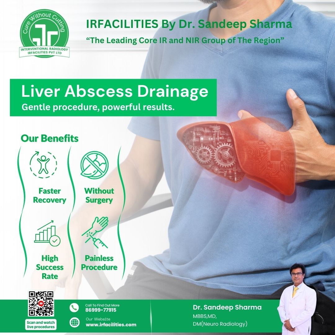 When Is Liver Abscess Drainage Needed?